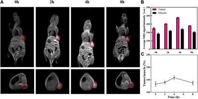 Redox/pH-responsive hollow manganese dioxide nanoparticles for thyroid cancer treatment